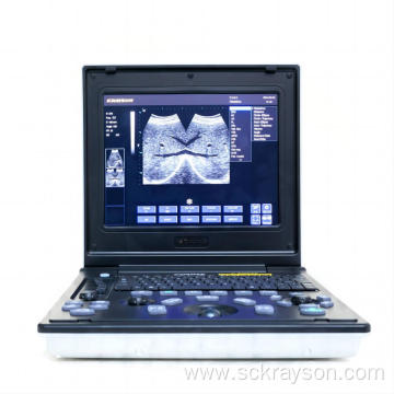 Gold gradient hearts ultrasound diagnostics equipment